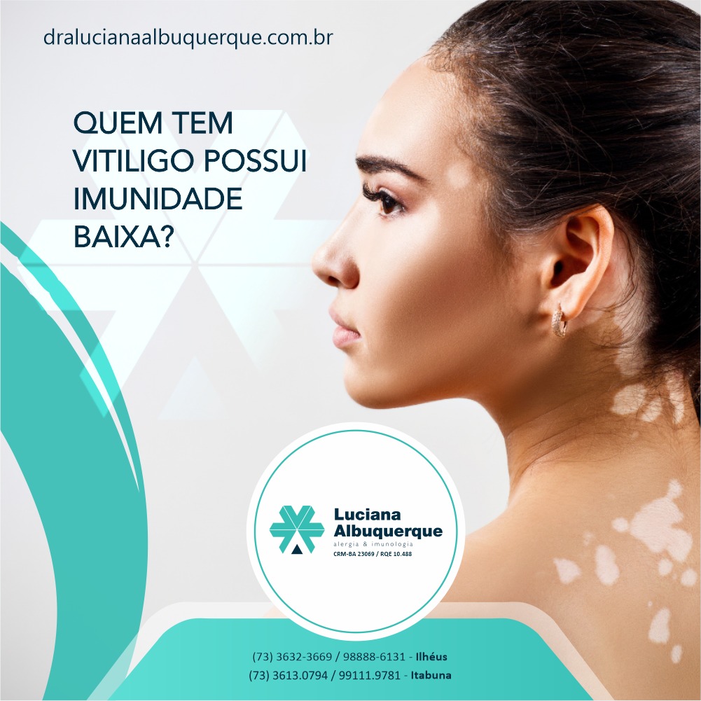 Quem tem vitiligo possui Imunidade baixa?