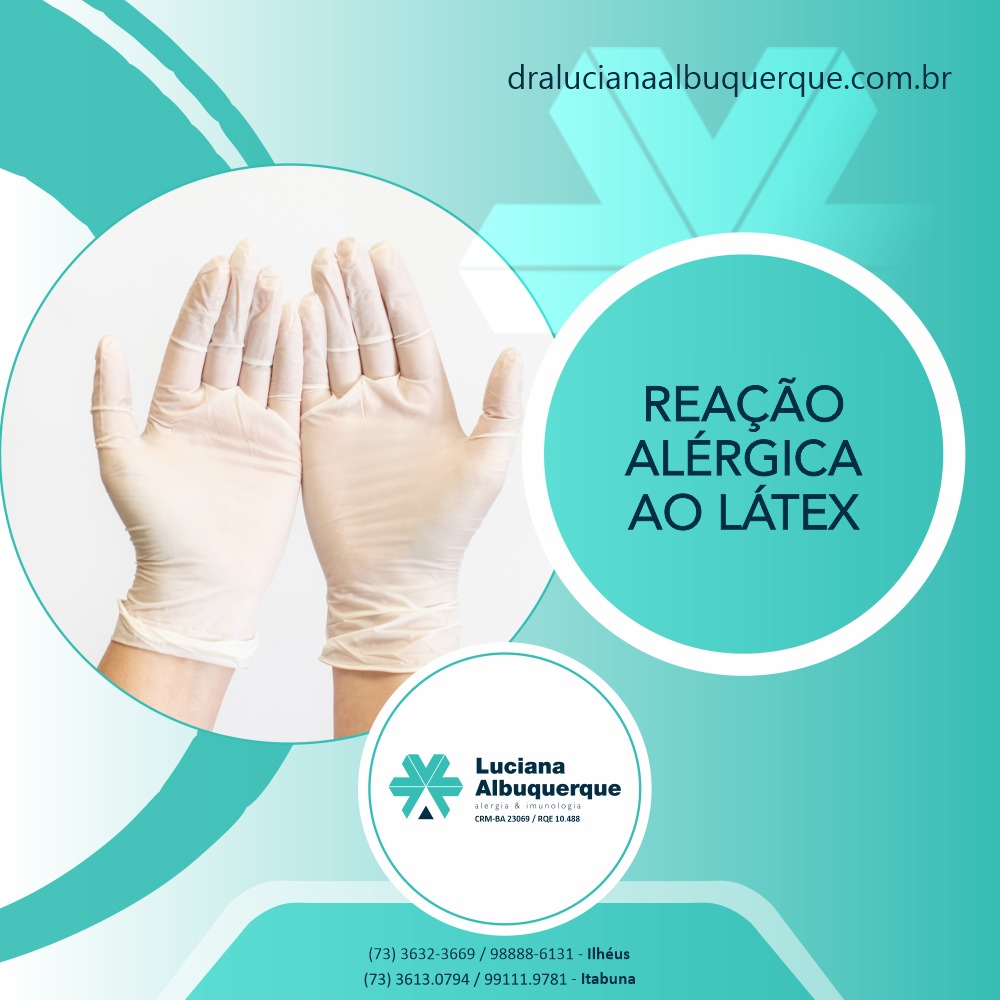 Reação Alérgica ao Látex