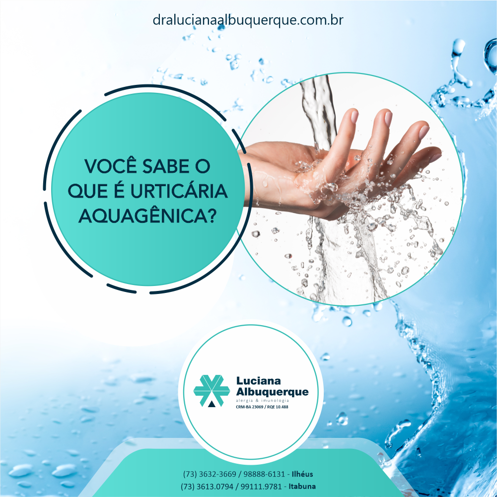Urticária Aquagênica